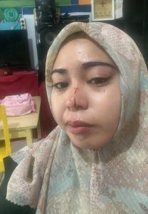Perempuan di Ternate Jadi Korban Penganiayaan Pamannya Sendiri