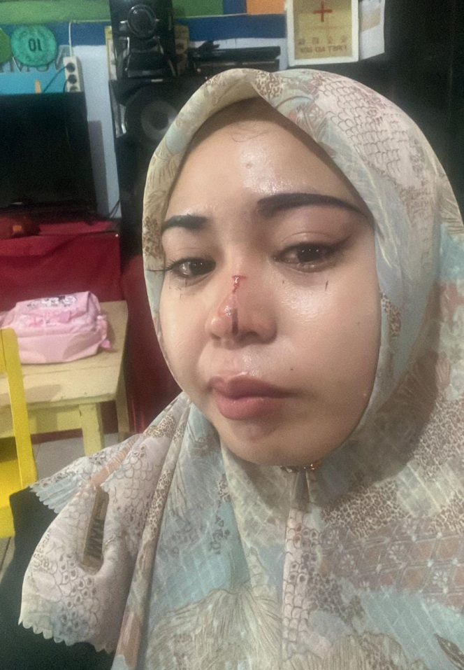 
 Perempuan di Ternate Jadi Korban Penganiayaan Pamannya Sendiri