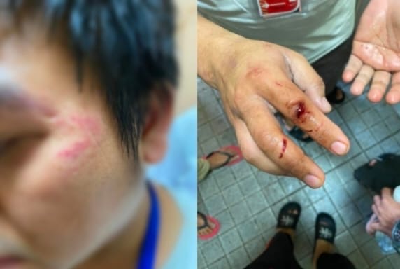 Empat Remaja Halsel Diduga Jadi Korban Perdagangan Orang, Dipaksa Bekerja dan Disiksa di Myanmar